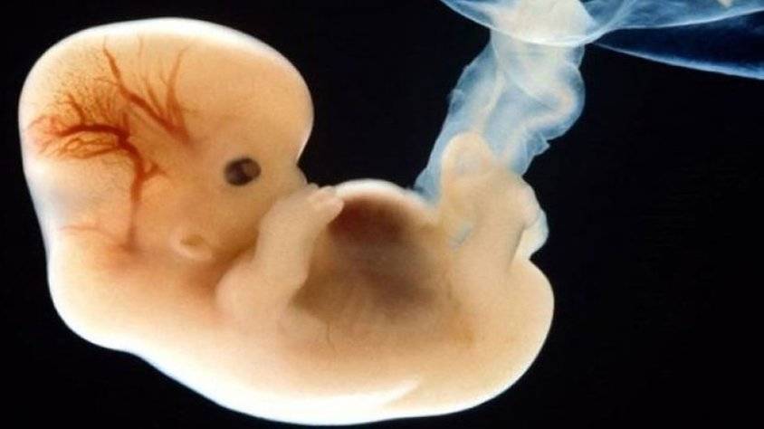 Анэмбриония или почему не видно эмбриона на УЗИ